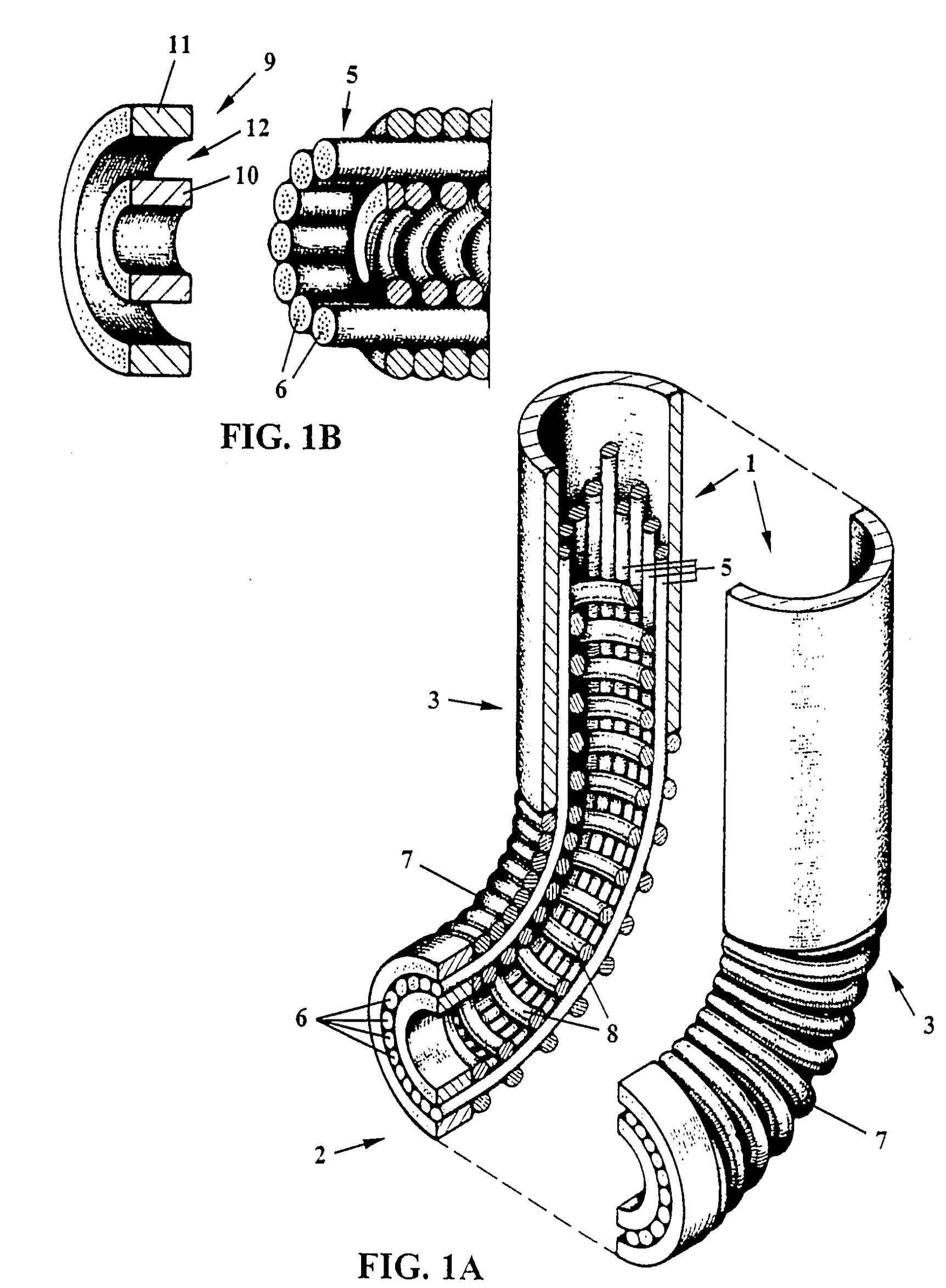 Figuur 5: Flexibele uiteinde endoscoop